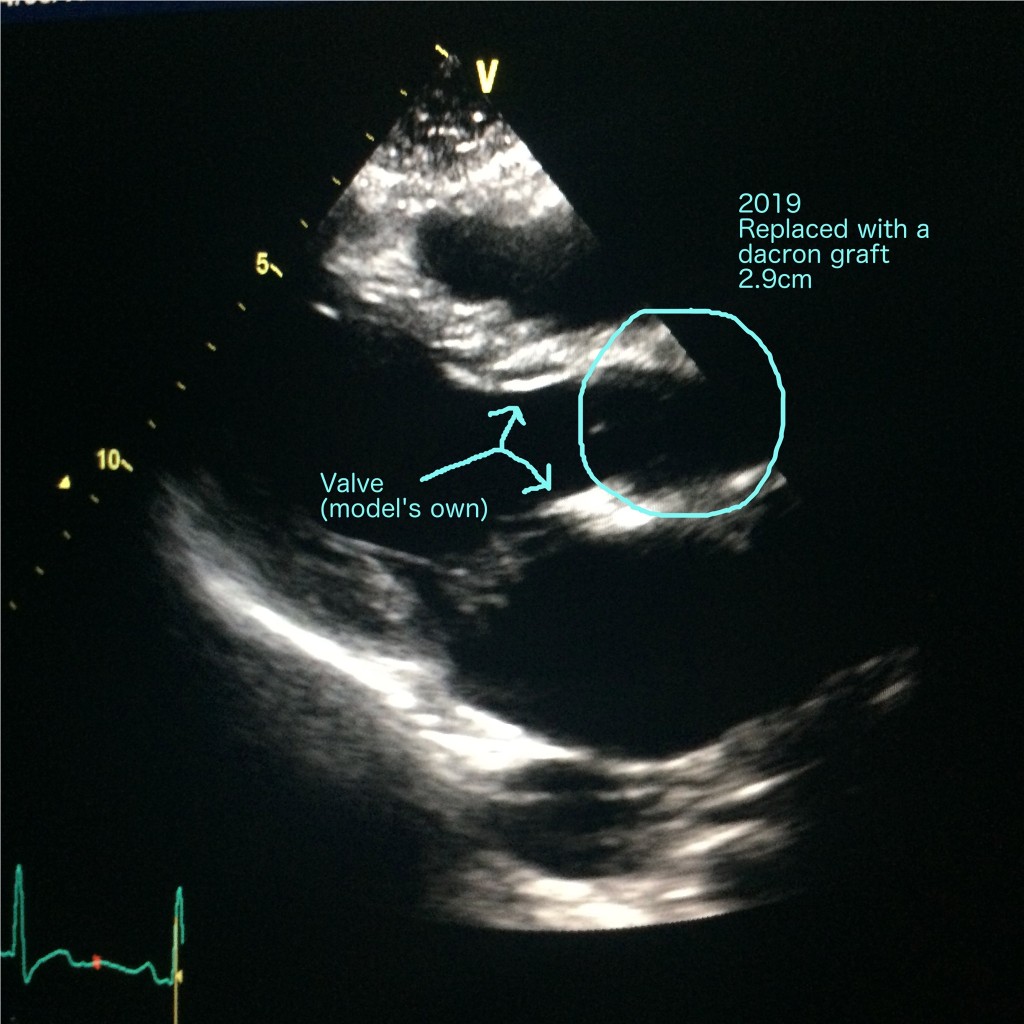 ultrasoundafter